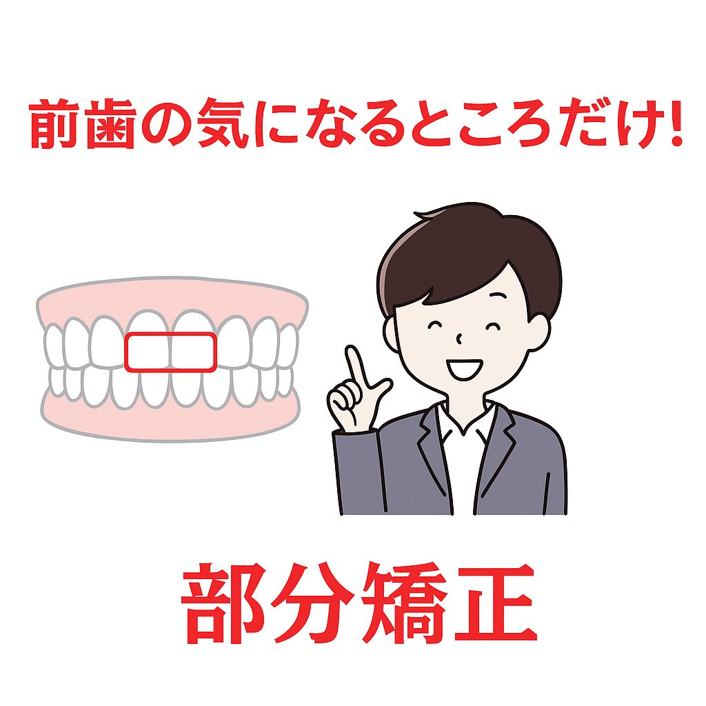 高崎市新町・藤岡市・玉村町・上里町で前歯だけの部分矯正を説明するイラスト