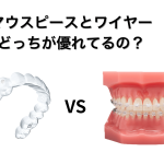高崎市新町・藤岡市・玉村町・上里町で矯正歯科をお探しの方へ｜マウスピース矯正とワイヤー矯正はどっちが優れてる？比較画像
